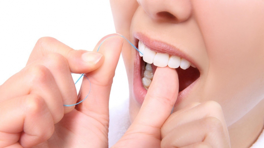 Làm thế nào để ngăn ngừa cao răng?